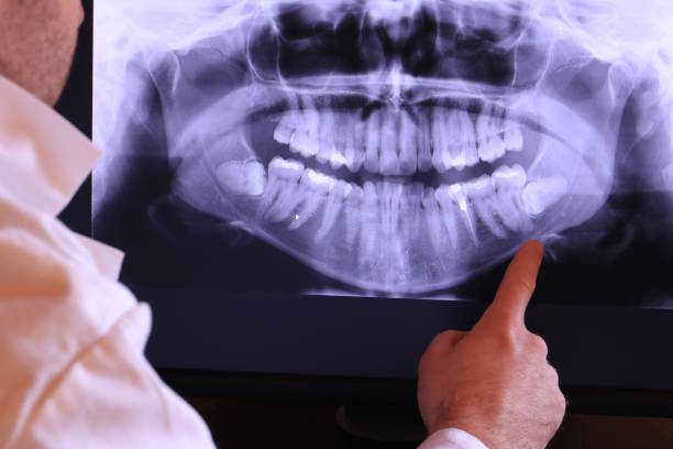 Best Emergency Tooth Extraction in Wamac, IN